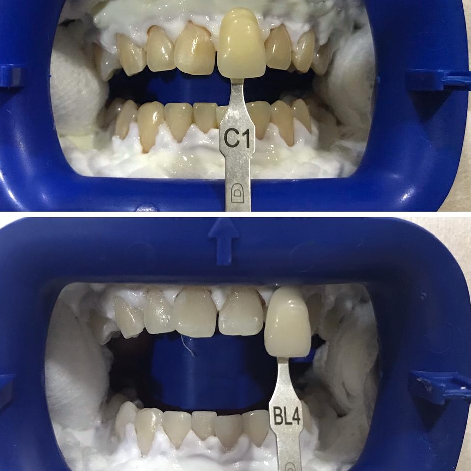 Qualiteeth Dental Clinic @Kepong ( Braces and Implant Dental Centre)